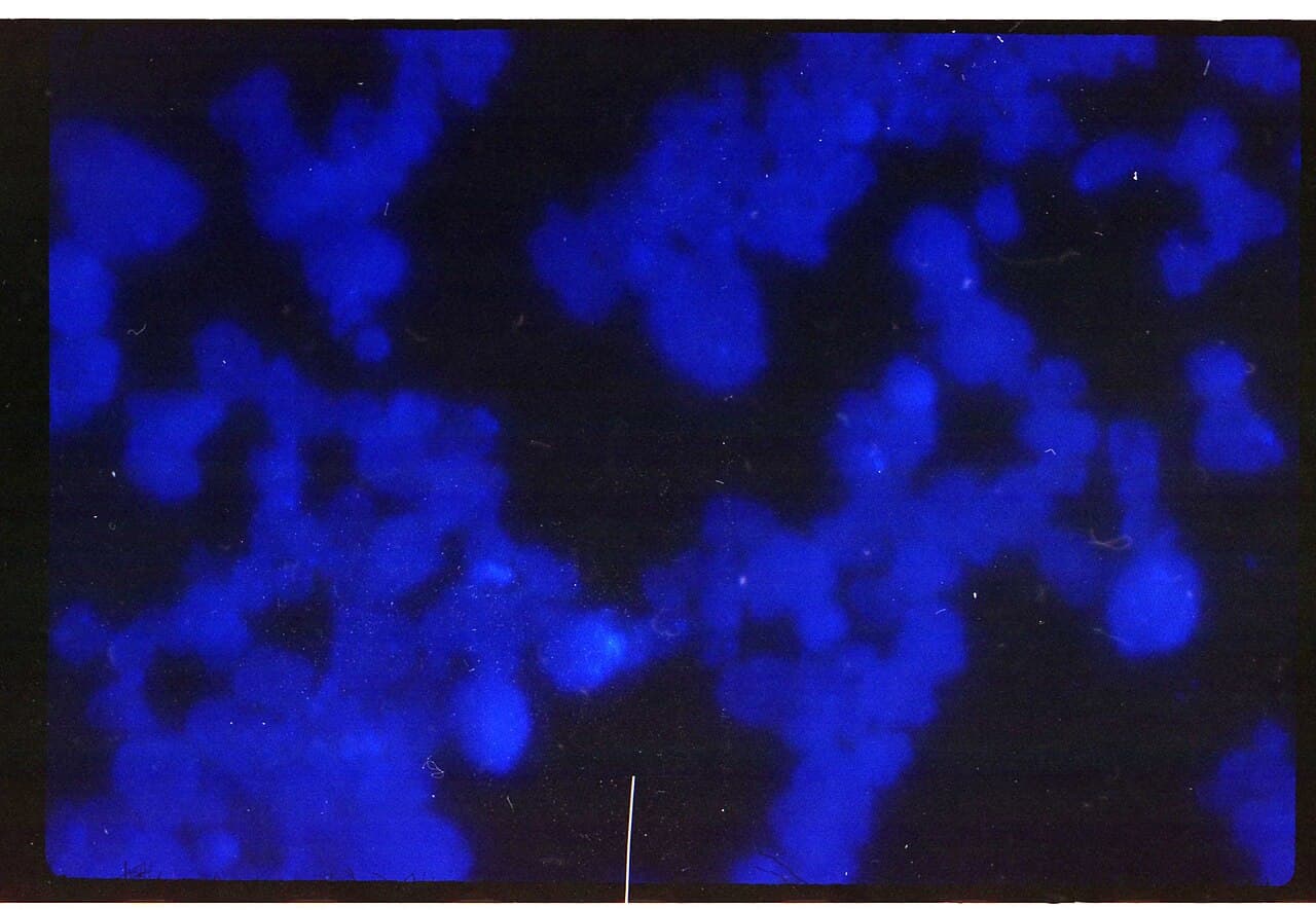 Aluminium Oxide